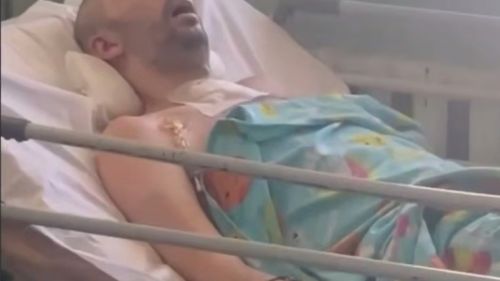 Ukrainians have the right to know who beats them: the ombudsman is outraged, a resident of Dnipro is in a coma